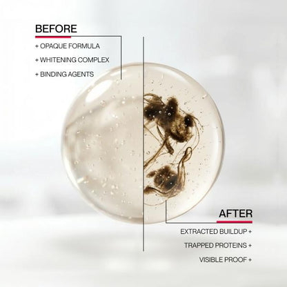 Gunk Removing Mouthwash - Remove Bad Breath And Whiten Teeth